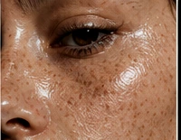 Macro detail of untouched skin: pores, freckles, texture.
